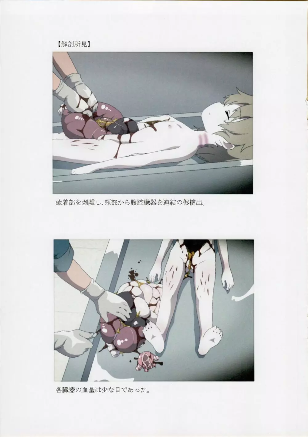 西荻窪少女殺害事件司法解剖記録 Page.8