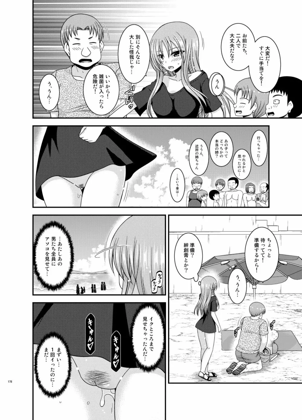 露出少女遊戯姦プラス Page.177